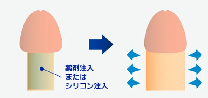 太く大きくたくましい見た目に